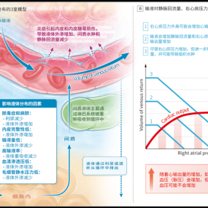 “把液体视为药物”！脓毒症患者液体治疗的“四部曲”